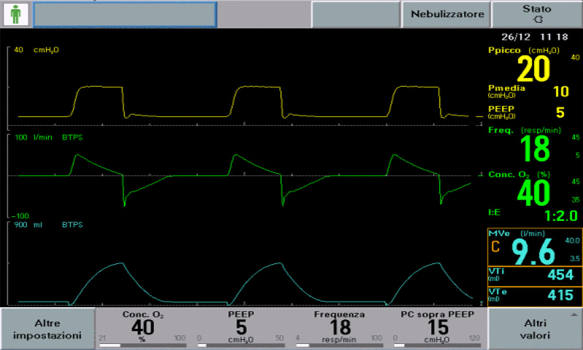 respiratori pressometrici