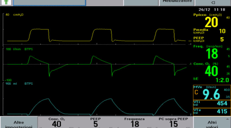 respiratori pressometrici