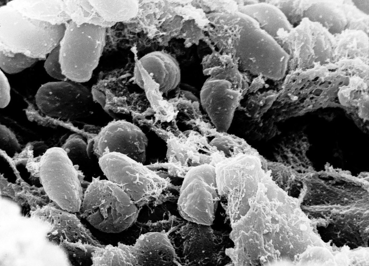 Yersinia Pestis Batterio Peste